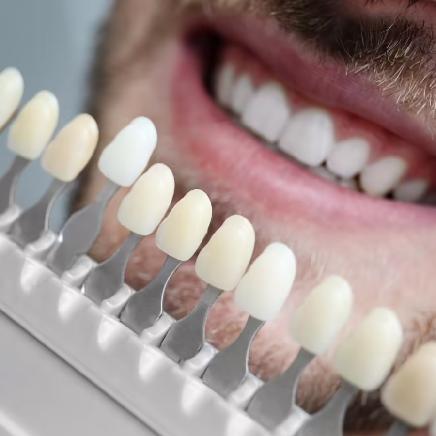 Cosmetic Dentistry