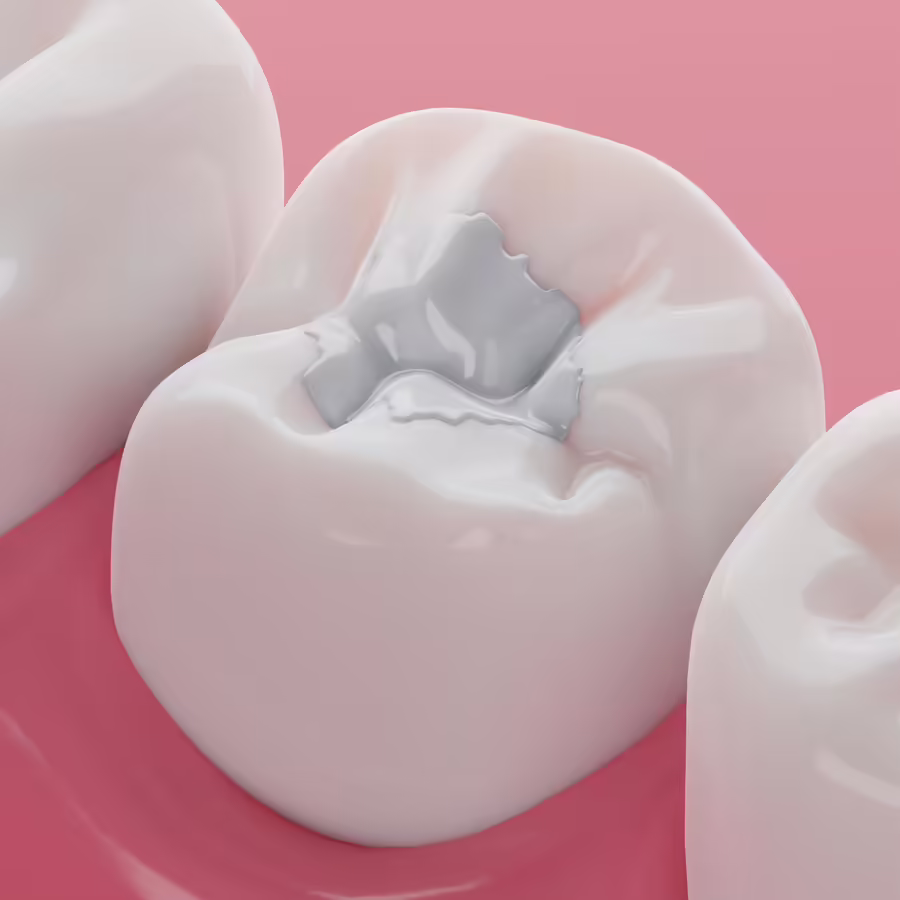 Laser Dentistry